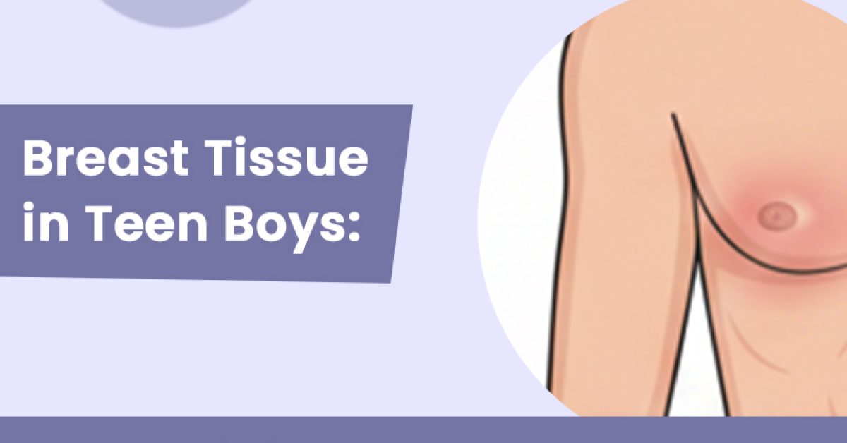 Breast tissues